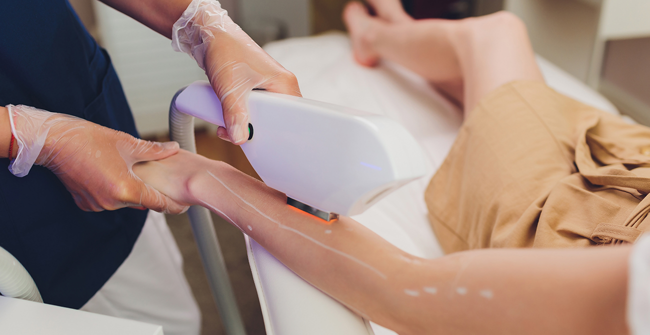 Laser Hair Removal