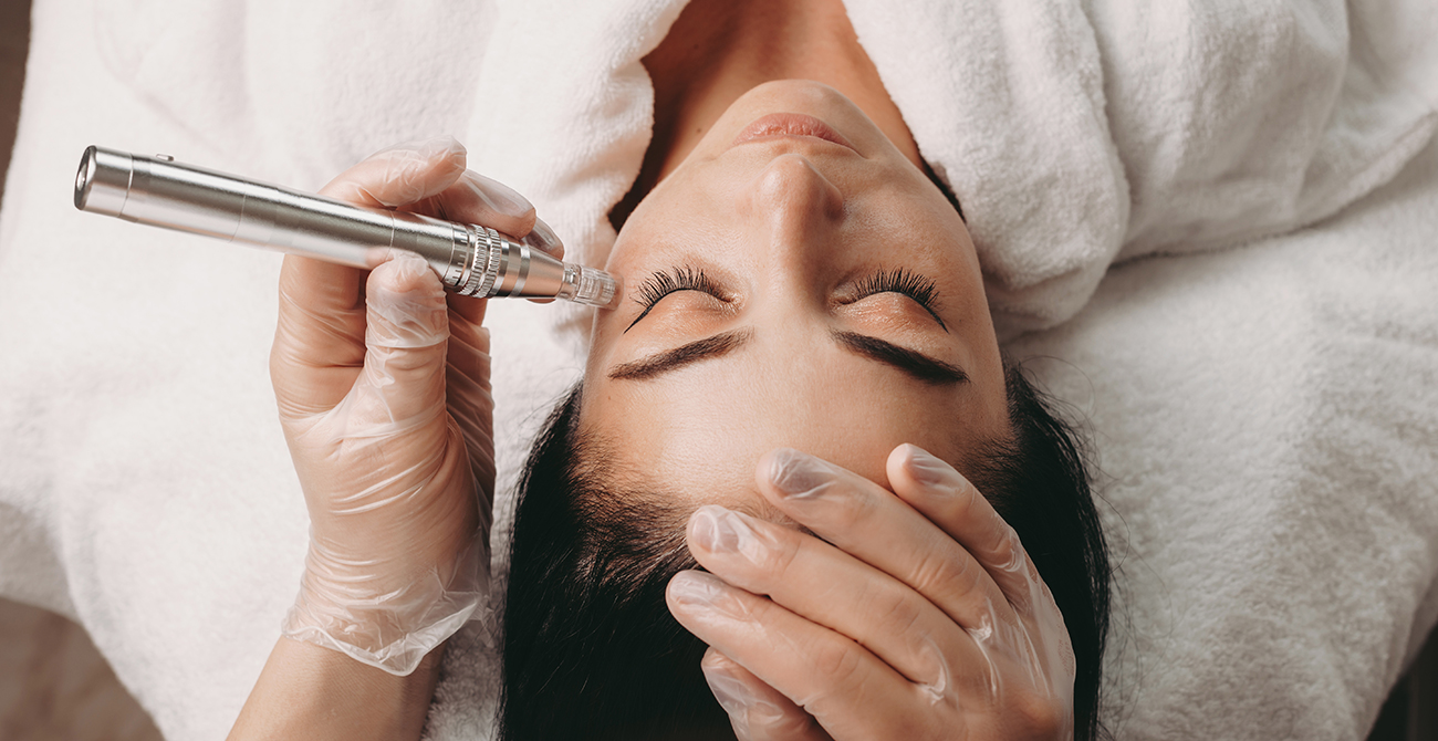 Pigmentation Melasma